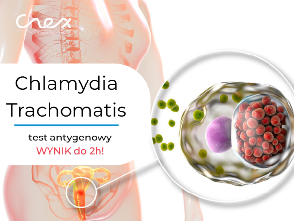 Chlamydia Trachomatis - test antygenowy CITO