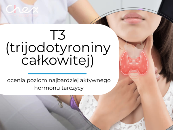 T3