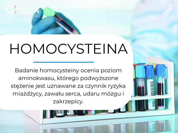 HOMOCYSTEINA