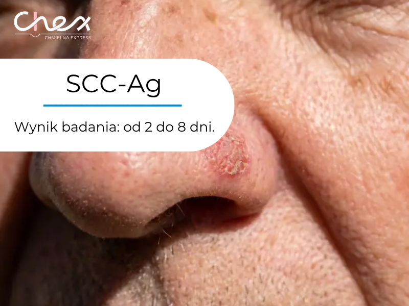 SCC-Ag