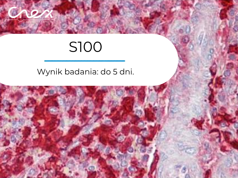 S100