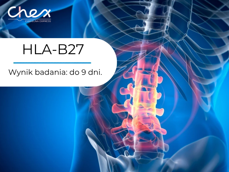 HLA-B27