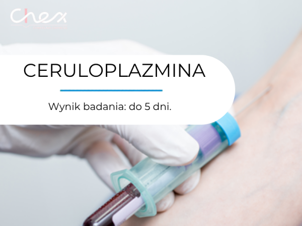 CERULOPLAZMINA