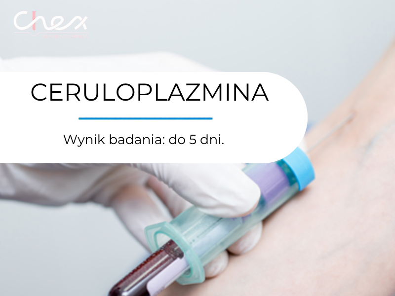 CERULOPLAZMINA