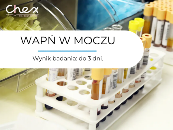 WAPŃ W MOCZU