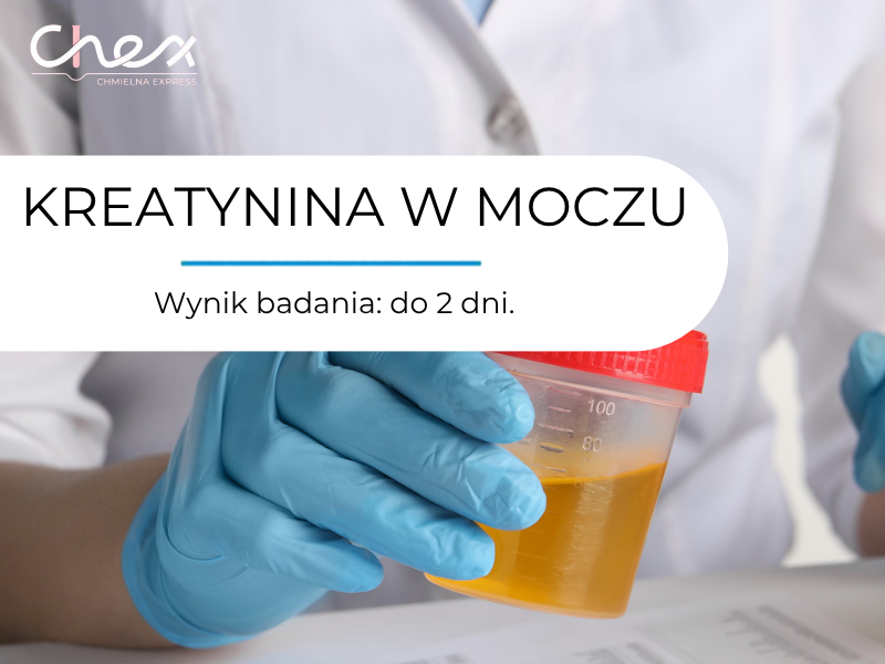 KREATYNINA W MOCZU