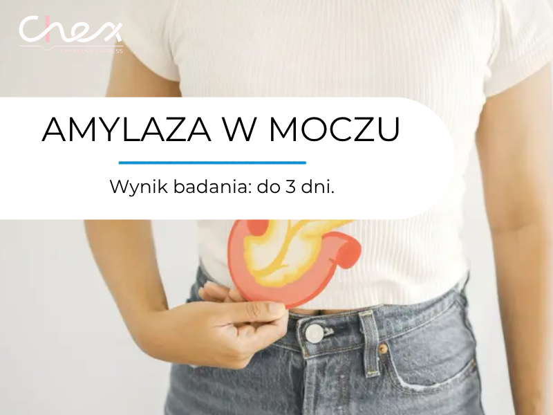 AMYLAZA W MOCZU